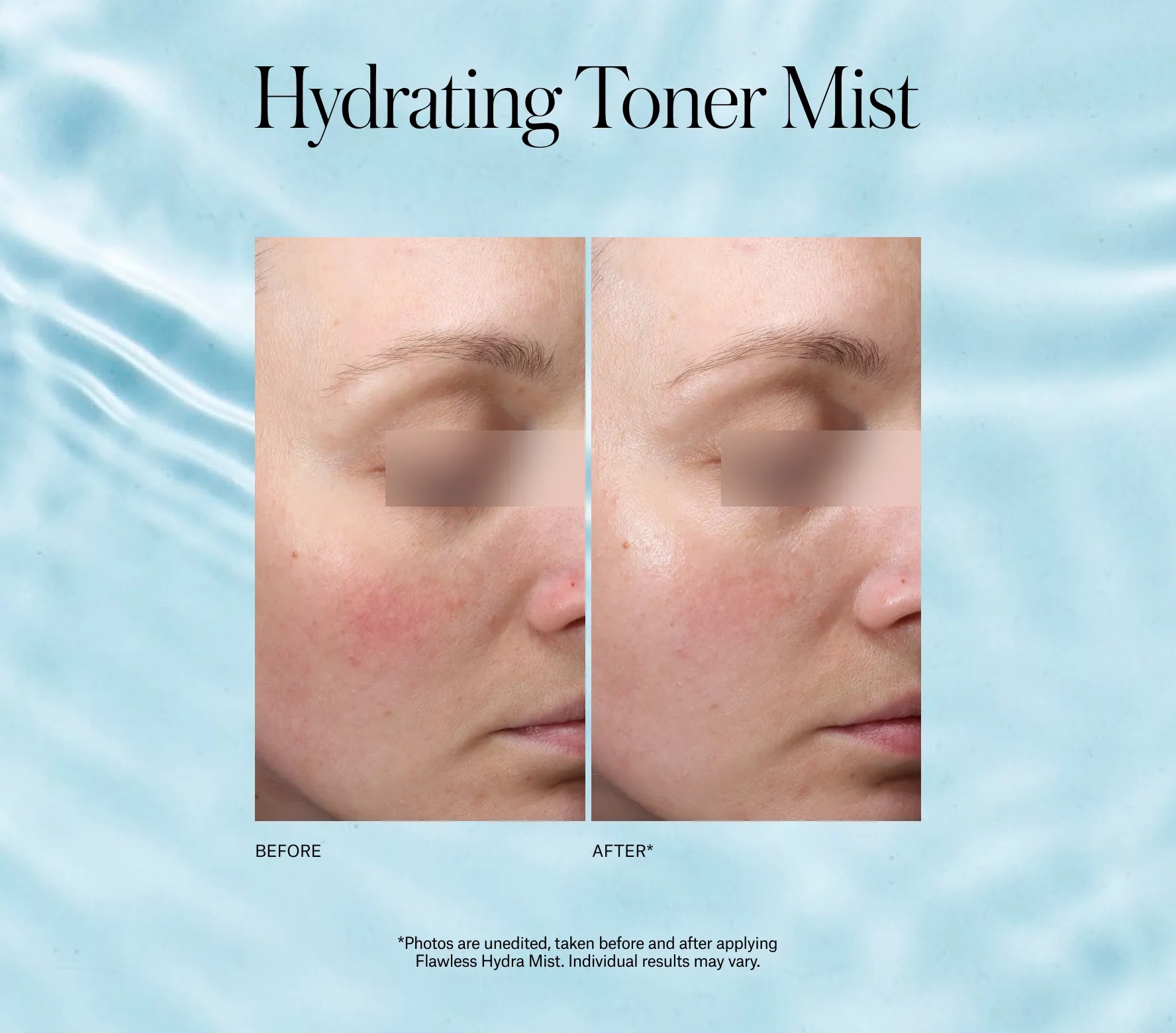 Flawless Hydra Mist Classic